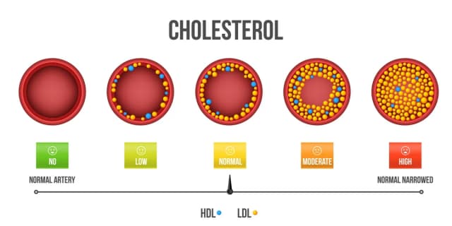 Jaki cholesterol jest dobry i jak poprawić jego poziom w organizmie Jaki cholesterol jest dobry i jak poprawić jego poziom w organizmie