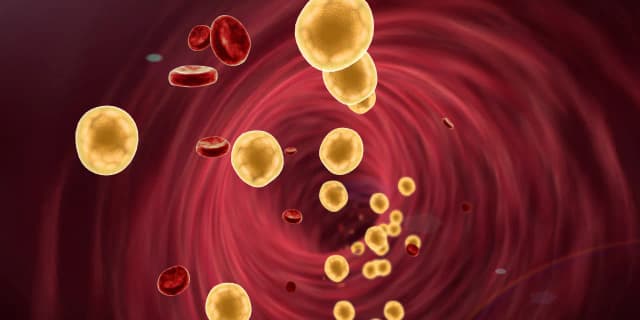 Jak obniżyć cholesterol na diecie keto? Skuteczne strategie i porady Jak obniżyć cholesterol na diecie keto? Skuteczne strategie i porady