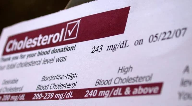 Jak oznaczony jest cholesterol na wynikach? Zrozum swoje wyniki zdrowotne Jak oznaczony jest cholesterol na wynikach? Zrozum swoje wyniki zdrowotne