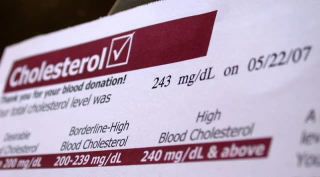 Jak oznaczony jest cholesterol na wynikach? Zrozum swoje wyniki zdrowotne Jak oznaczony jest cholesterol na wynikach? Zrozum swoje wyniki zdrowotne